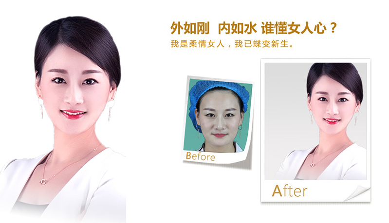 昌都地区V脸、线雕隆鼻